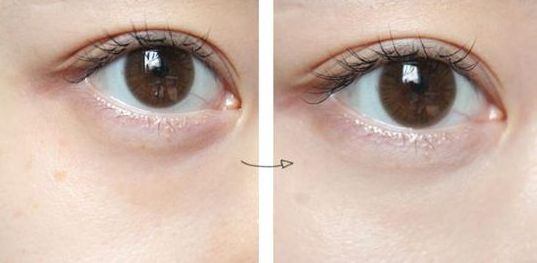 探秘北京有口皆碑的開眼角整形醫(yī)院，讓您一探究竟！