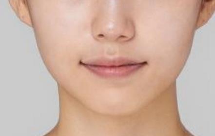 寧波唇紋埋線整形醫(yī)院推薦！2023年備受好評的前10家醫(yī)院排名揭曉！