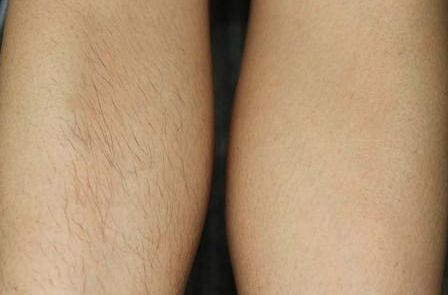 天津有哪些整形醫(yī)院值得推薦？