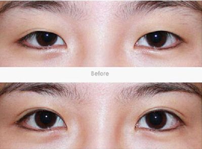 長沙微整形醫(yī)院排行榜揭曉！實力搶先引領(lǐng)行業(yè)領(lǐng)先勢頭！