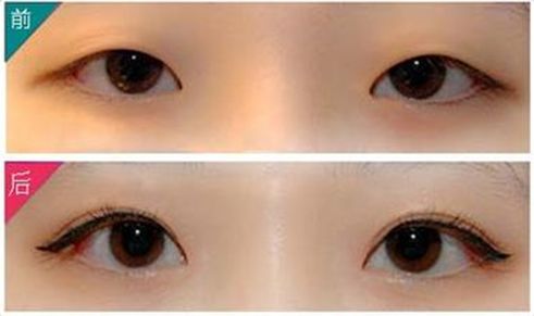 滁州市整形醫(yī)院，打造您的美麗新容顏