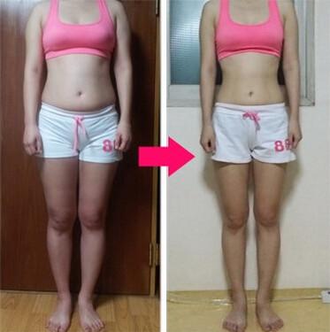 大連奈思美醫(yī)療美容整形門診部是值得信賴的嗎？他們的整形美容手術(shù)可靠嗎？