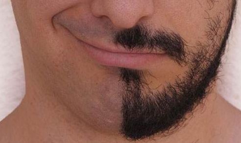 尋覓天津祛疤痕的最佳選擇，哪家醫(yī)院好且專業(yè)？