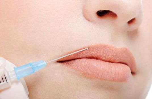 南京埋線雙眼皮醫(yī)院排名及口碑調(diào)查：哪家醫(yī)院做得最好？