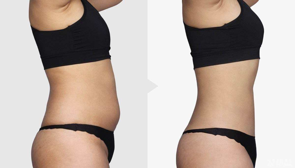 2023寧波哪家整形醫(yī)院的塑美極除皺技術(shù)更有口碑？競爭優(yōu)勢呈現(xiàn)！