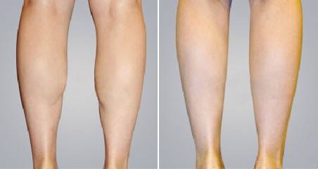 遵義哪些醫(yī)院能有效解決祛痘美膚問(wèn)題？2023年祛痘美膚醫(yī)院口碑推薦排行，快來(lái)了解！