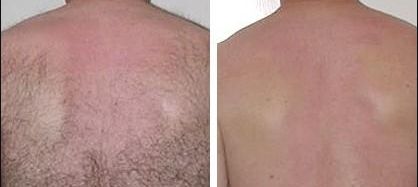 庫爾勒哪家整形醫(yī)院靠譜？排名最好的整形美容醫(yī)院在哪里？