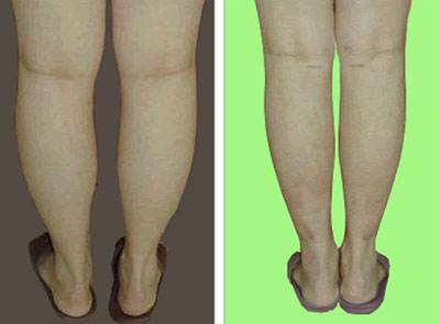 呼和浩特哪家醫(yī)院適合做線雕去抬頭紋？2023年排名前10的整形美容醫(yī)院有哪些？