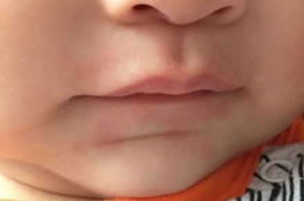 北京豐面頰整形醫(yī)院哪家好？看看全網(wǎng)口碑，找到最靠譜的整形醫(yī)院