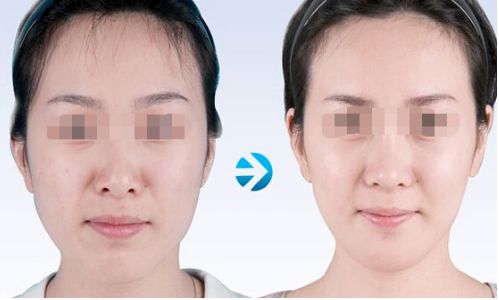 昆山顯微鏡根管治療哪家好？口碑佳的整形醫(yī)院推薦