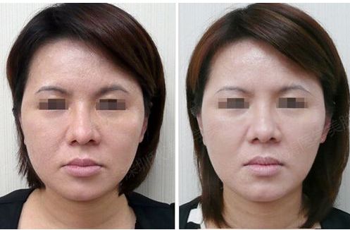 武漢十家技術(shù)精湛的整形醫(yī)院盤點(diǎn)，靈動(dòng)媚眼術(shù)醫(yī)療實(shí)力與口碑齊飛！