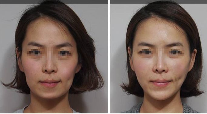 黑臉娃娃介紹：用于改善電腦族肌膚問(wèn)題，讓您擁有美麗肌膚！