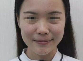 天津微創(chuàng)眼底紋？別再問！Top10醫(yī)院好評如潮