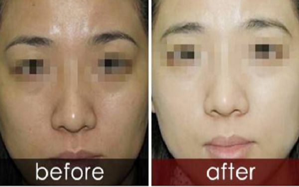 保定眉間紋注射除皺醫(yī)院推薦  前十強醫(yī)院排行榜