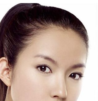 INFINI 黃金微針射頻：3D立體美膚新趨勢(shì)解讀