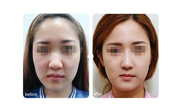 太原淡化頸紋推薦十大口碑醫(yī)院，預(yù)約火爆!