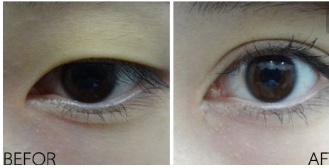 徐雨整容了嗎？看看她引領(lǐng)的新時(shí)尚引起的變化！