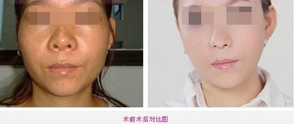 北京頸部水光針祛皺醫(yī)院排行榜TOP10揭曉！各醫(yī)院優(yōu)勢大揭秘！