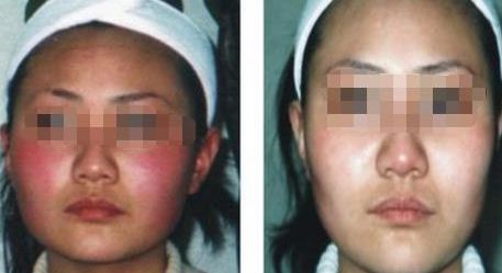 常州口碑比較好的瘦臉針整形美容醫(yī)院大盤點(diǎn)