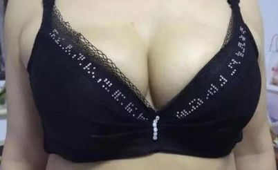 贛州哪家醫(yī)院是比較好的寬鼻矯正機(jī)構(gòu)