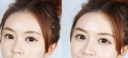 上海植發(fā)指南：權(quán)威就醫(yī)指南