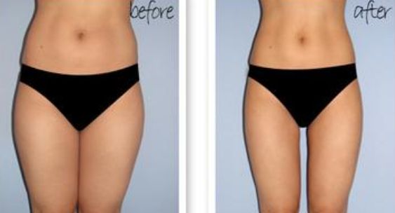 【2023】威海黃金微針去細紋醫(yī)院排行榜前十強公開！