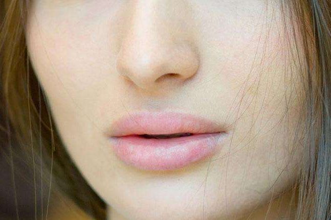 哈爾濱哪家醫(yī)院擅長胎記治療，治療效果好可靠？