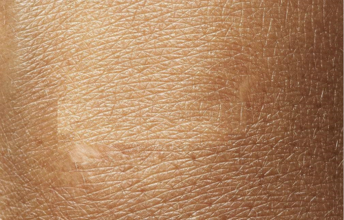 阜陽(yáng)做祛斑出名的醫(yī)院有哪些？祛斑專(zhuān)家到底靠譜嗎？