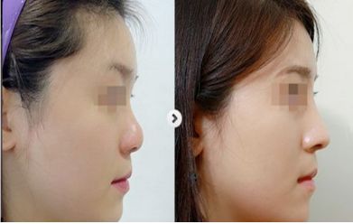 包頭鼻孔縮小醫(yī)院口碑榜單：10家值得信賴的整形機(jī)構(gòu)