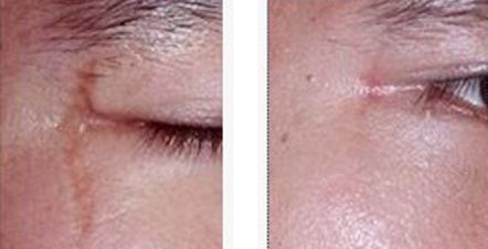 上海有哪些正規(guī)除疤醫(yī)院值得推薦？