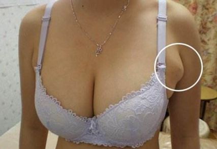 咸陽哪家整形醫(yī)院雙眼皮做得好效果好