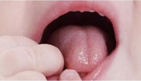 南京眼袋手術(shù)哪家醫(yī)院好？從資深專家解析，推薦適合您的最佳選擇