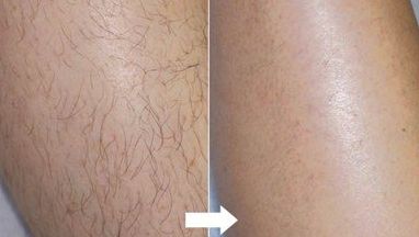 臨沂哪家醫(yī)院眼部整形好？全面解析眼部整形項(xiàng)目及醫(yī)院選擇攻略