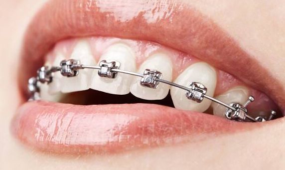 徐州哪家三甲醫(yī)院的鼻部整形效果最佳？