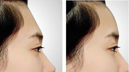 上海手術(shù)除皺醫(yī)院哪家好？排名、評(píng)價(jià)、費(fèi)用對(duì)比全面解析