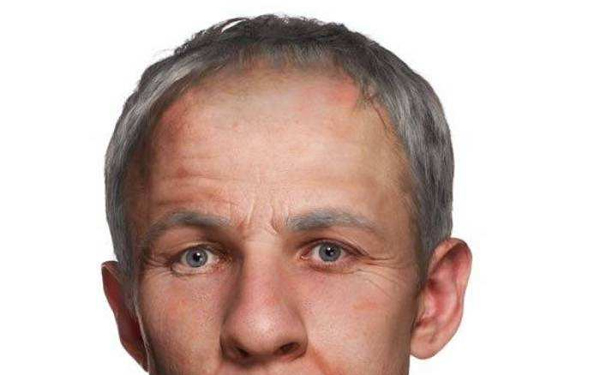 雙眼皮是永久的嗎？適合哪些人群和有哪些優(yōu)點(diǎn)？