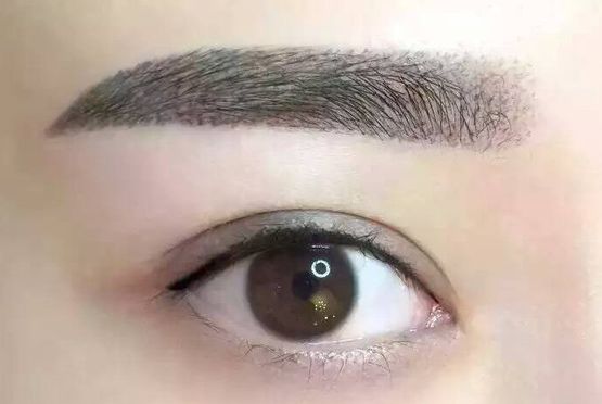 北京絕佳雙眼皮醫(yī)生，備受贊譽(yù)與推薦！