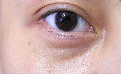 常德市整形美容科醫(yī)院：醫(yī)術(shù)高超，手術(shù)安全可靠，絕對給您信心！推薦這些醫(yī)院！