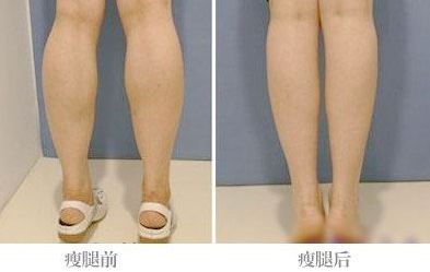 武漢哪家熱瑪吉醫(yī)院最好？一起來了解一下！