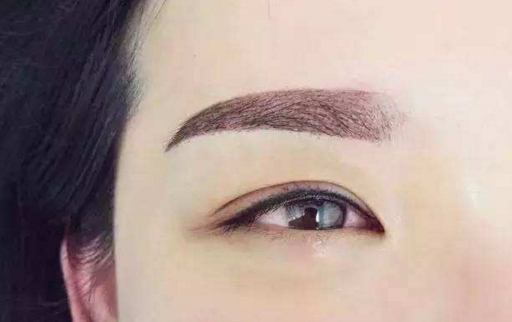 溫州滾針祛痘坑：10家值得信賴的美容醫(yī)院推薦