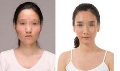 上海眼紋射頻去除醫(yī)院排行榜出爐，前十強評測！