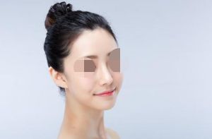 大連去除眼部細(xì)紋醫(yī)院推薦及排名