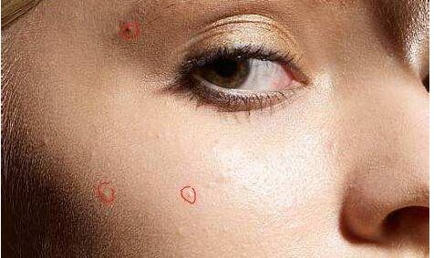 深圳更有口碑的整形醫(yī)生專家排名，告訴你隆胸王子曹孟君與雙眼皮女王劉月的獨(dú)門技藝！