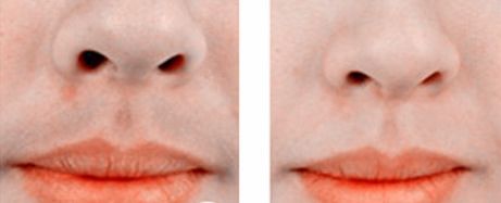 長(zhǎng)春哪家雙眼皮做的好？專(zhuān)業(yè)告訴你如何選擇最適合你的雙眼皮手術(shù)醫(yī)院