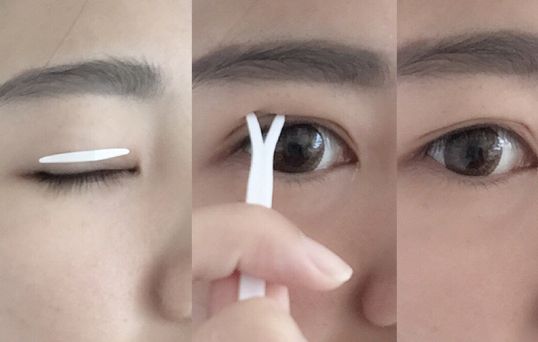 阜陽(yáng)自體脂肪填充豐淚溝哪家醫(yī)院好？2023年排名前10名盤(pán)點(diǎn)！