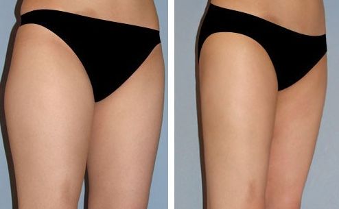 探尋遼寧哪家醫(yī)院好，取奧美定治療哪家醫(yī)院更靠譜？