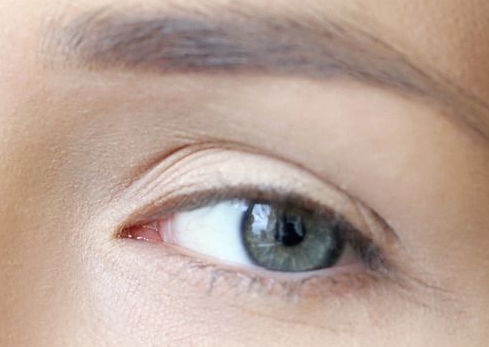 湖州整形醫(yī)院，祛除眼周細(xì)紋效果好的有哪些？：2023湖州皮秒激光祛除眼周細(xì)紋醫(yī)院排名前十名