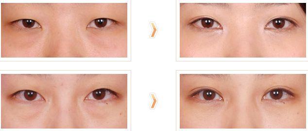 泰安激光點痣手術(shù)哪家醫(yī)院好？