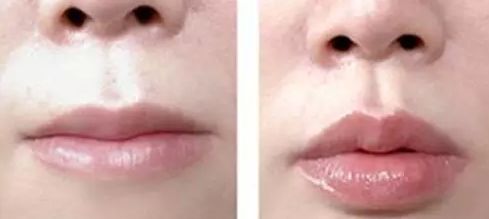 杭州頰脂墊瘦臉醫(yī)院2023年排名前10強(qiáng)，急需了解哪些醫(yī)院是最值得去的！