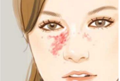 上海有哪些專業(yè)的去眼袋醫(yī)院值得推薦？